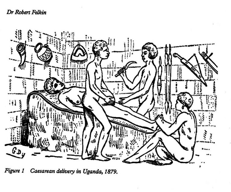 Ancient Surgeons of Africa – Banyoro of Western Uganda